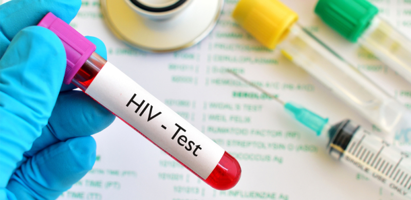 Cost Effective Strategies Of Testing For Hiv And Sexually Transmitted